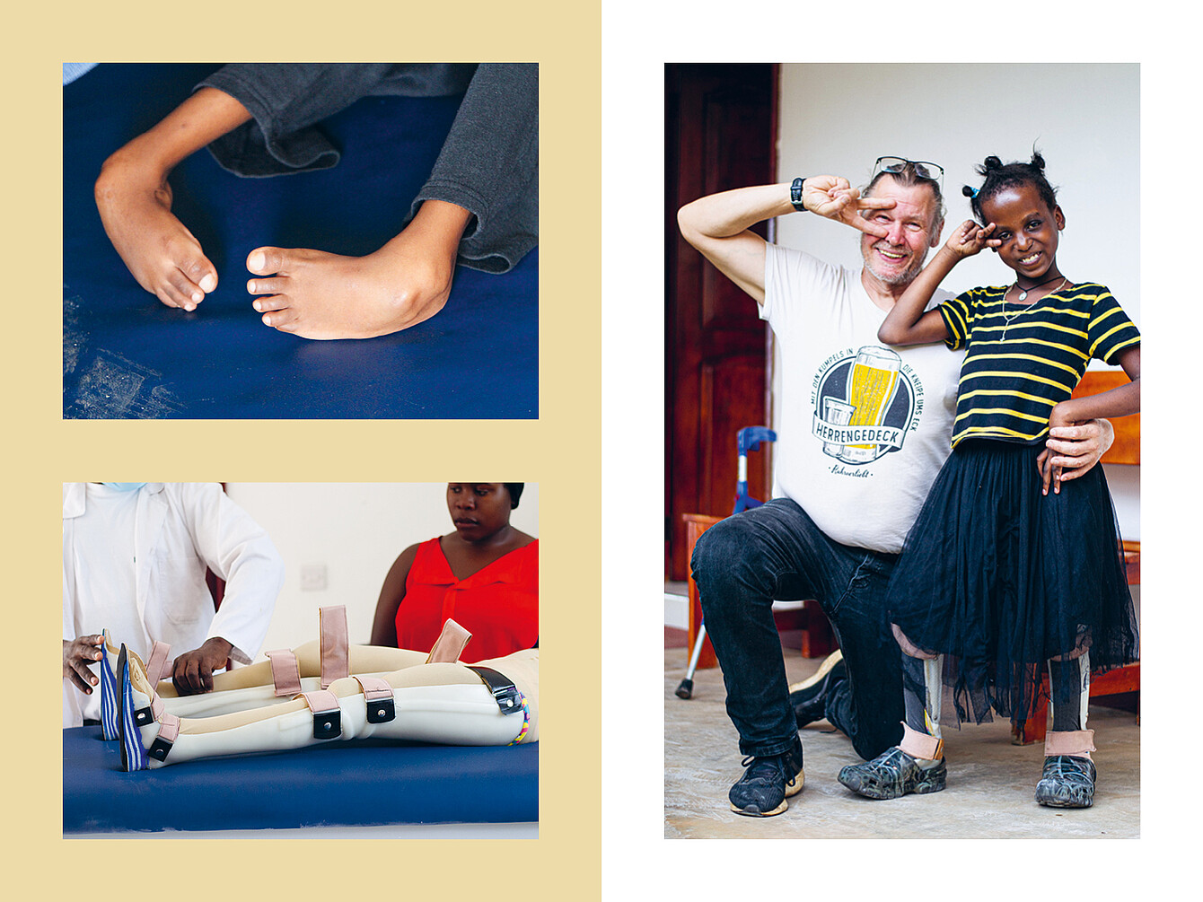 Child's feet with visible toes resting on a blue surface. Prosthetic legs with straps and buckles on a blue surface. Man and girl posing with arms raised; man wears white T-shirt with 'PRO UGANDA' logo, girl wears striped top and black skirt.